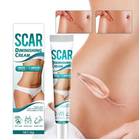 AuraBeen Scar Cream for Face & Body - Assists in Enhancing The Look of Stretch Marks, C - Section Scars, Surgical Scars - Suited for Old & New Scars - Facilitates Skin Restoration