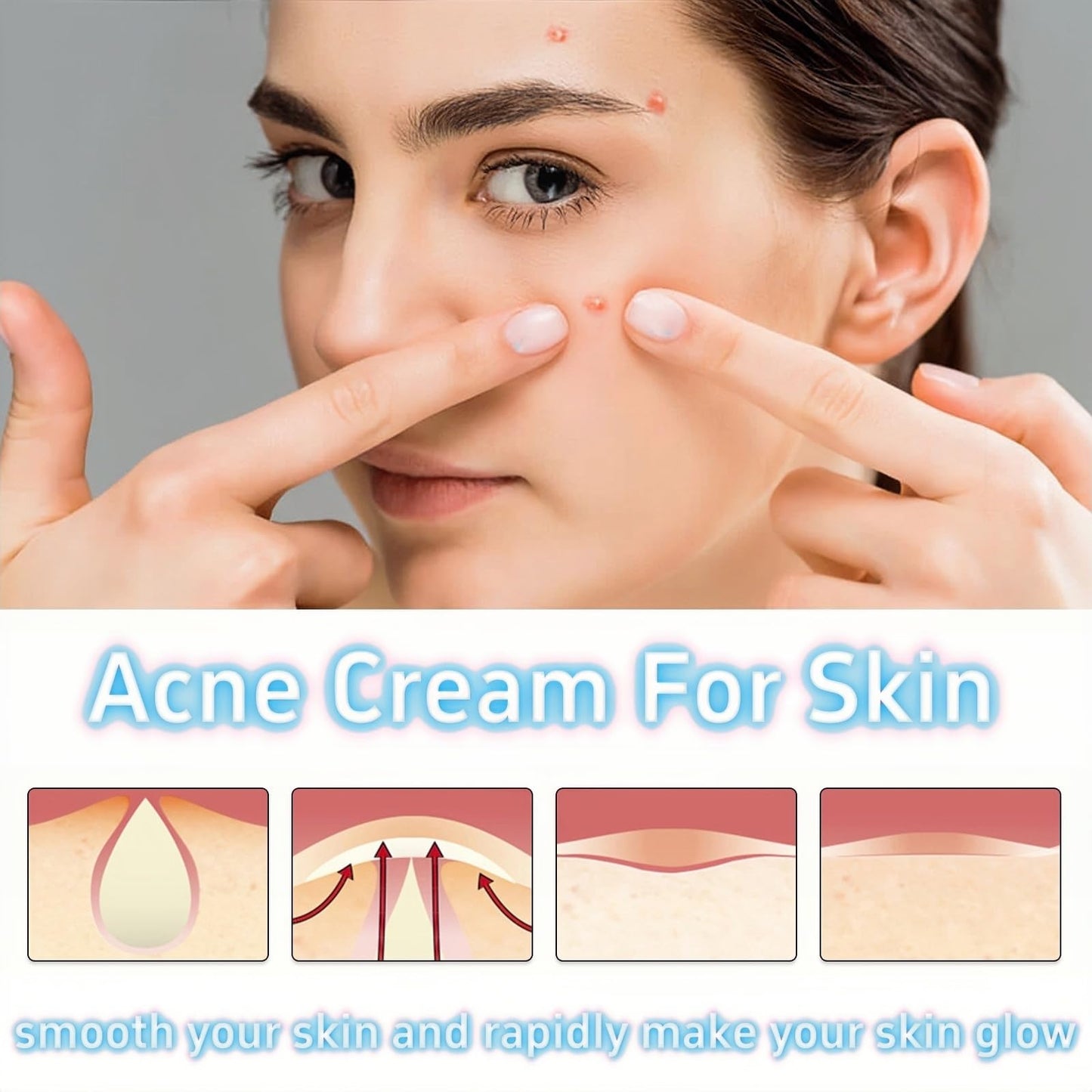 Xunzhi Acne Control Cream for Face,Acne Treatment Gel,A-cne Treatment,A-cne Face Cream,Ac-ne Gel Fast Absorbing Spot T-reatment,Anti Ac-ne F-ace C-ream,Acn-e C-ream for F-ace,Fa-ce Acn-e T-reatment