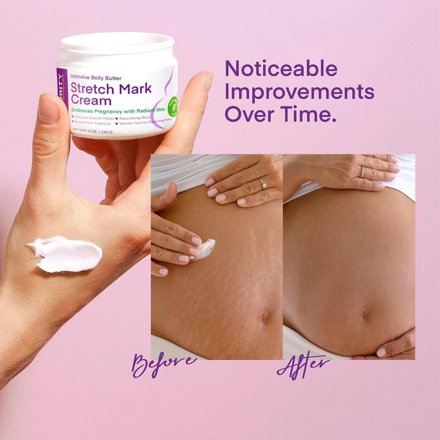 Vigority Stretch Mark Cream for Pregnant Women: Belly Butter for Expecting Moms - Moisturizing Lotion for Skin Elasticity - Maternity Skin Care Cream - 4 Oz