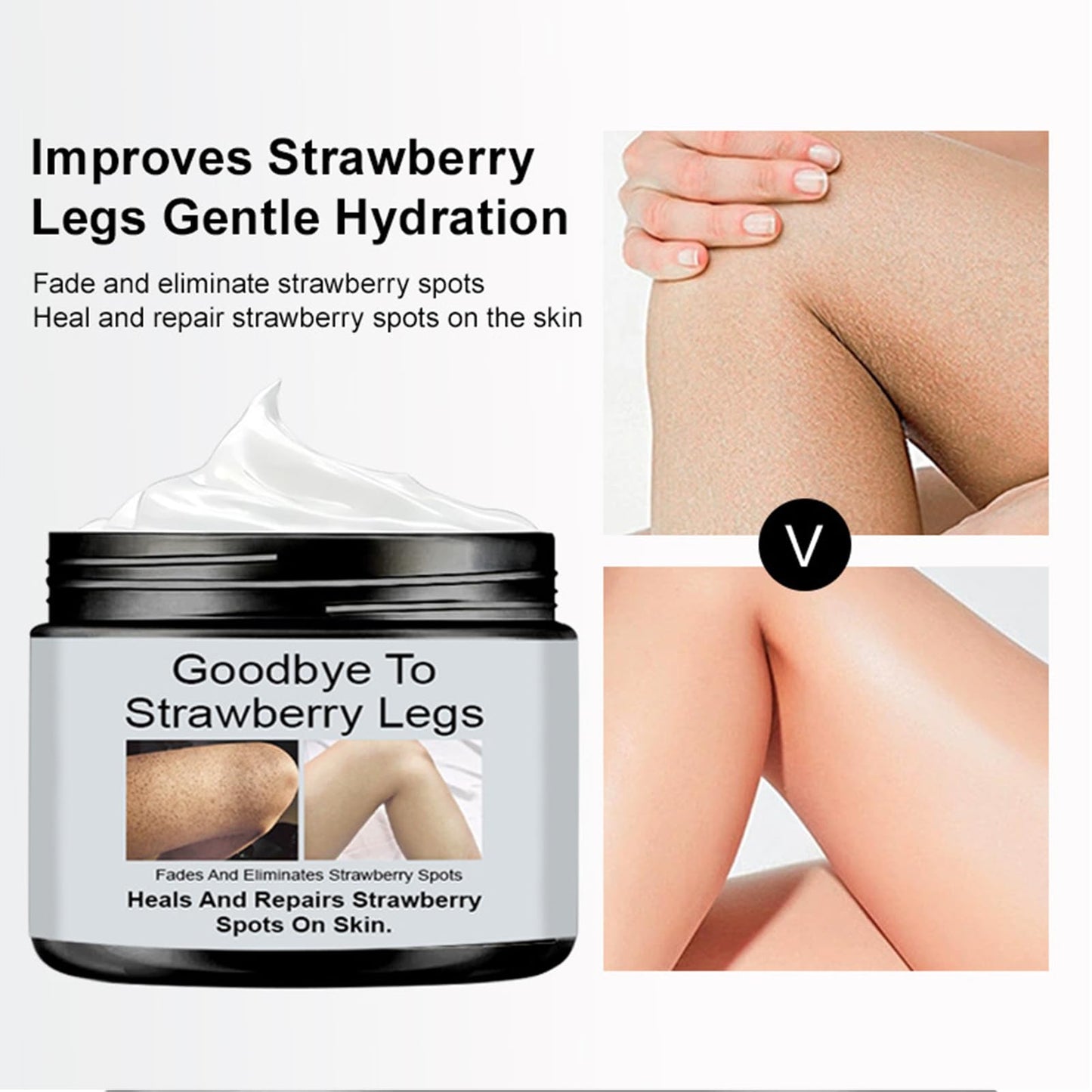 Strawberry Legs Treatment - Exfoliates & Moisturizes for Smooth Skin. Body Lotion for Rough, Uneven Texture Body Cream