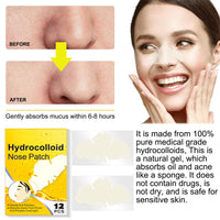 SHEBEEDO 12Pcs Hydrocolloid Nose Strips,Blackhead Remover Strips,Nose Pore Strips for Unclog and Shrink Pores,Absorbs Oil,Removal Acne,Pimple,Zits,Spot,Targets Pores & Pimples