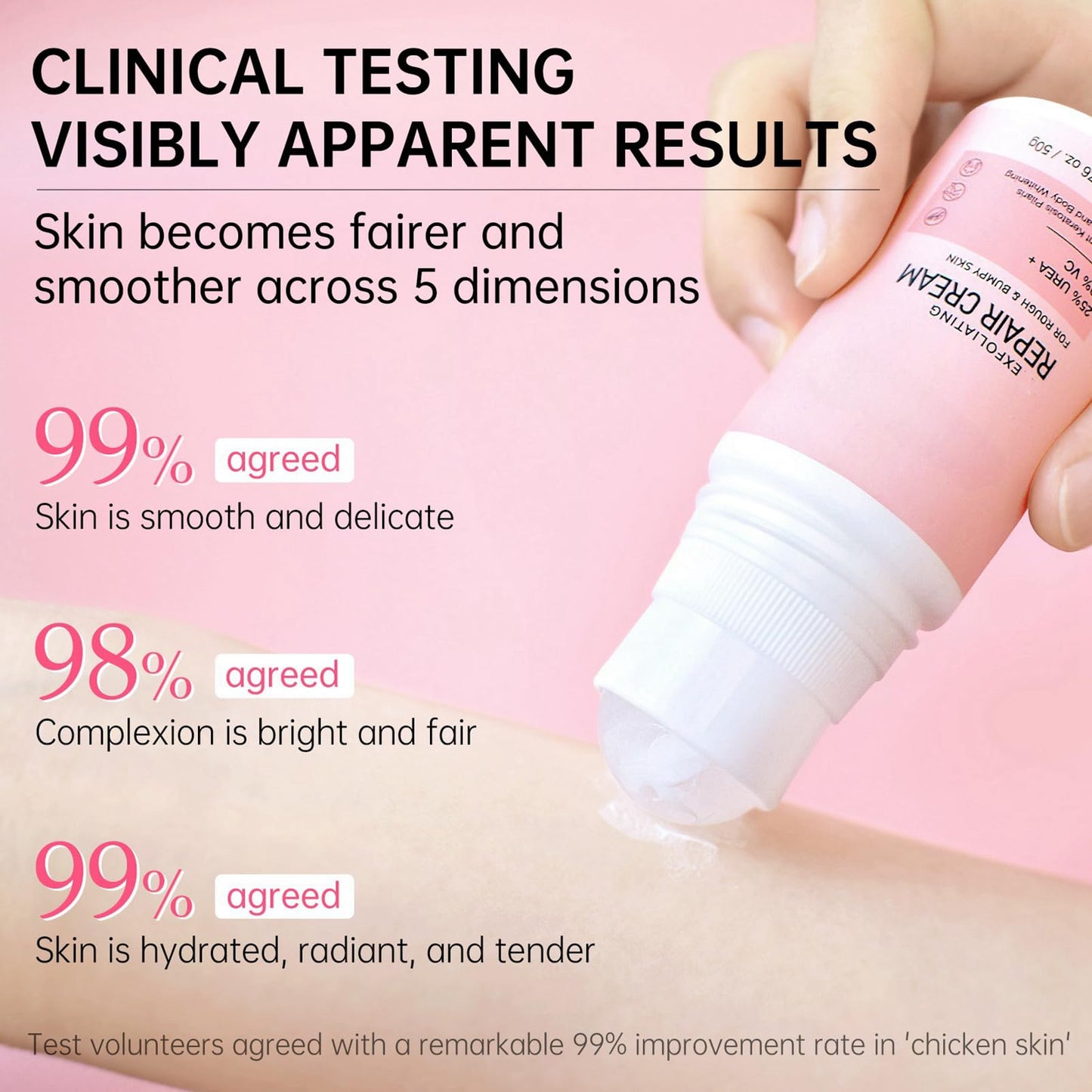 MEITREND Strawberry Skin Treatment,Skin Exfoliating Repair Cream with 20% Vitamin C and 25% Urea,Strawberry Legs Treatment Rough Bumpy Skin Body Lotion Moisturizing Cream,Chicken Skin Care Cream
