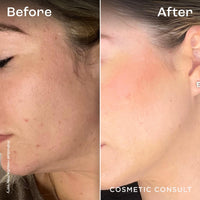 Cosmetic Consult Miracle Skin Transformation By Ashley Stobart | Rejuvenates & Refreshes Skin Overnight, Smooths Wrinkles & Acne, Boosts Collagen, Anti-Ageing Skin Cleanser | 1 x Single Wipe