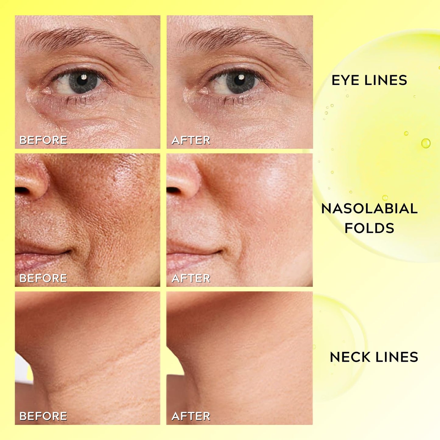 Retinol Shot Tightening Serum, Anti Aging Face Serum with Retinol Peptide, Wrinkles and Fine Lines, Firmer Skin, 30ml
