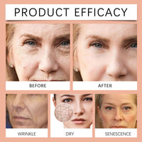 SingHao 100% Pure Organic Para/cress Facial Oil,Paracress Facial Oil Se/rum,Anti-Aging Moisturizing Essential O/il,Paracress Anti-Wrinkle Ser/um,Natural Para/cress Extract O/il for Women,Anti Aging Serum