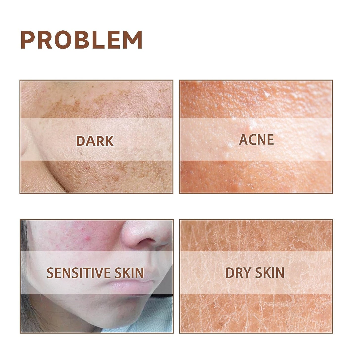 OuXing Spot Cream,Spot Treatment,Spot Remover,Spot Treatment for Face,Cream for Dark Skin Treatment,Anti Aging Face Cream,Spot Remover for Face,Freckle Removal Cream,Spot Corrector,Age Spot Remover for Face