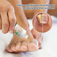 Yoowan Foot Cream For Cracked Heels And Dry Skin,Cracked Heel Repair Cream,Hard Skin Remover Foot C-ream,Dry Feet Treatment,Repairing Cracked Heel And Itchy Feet,Hydrate&Soften,For Heels,Knees,Elbows&Hands