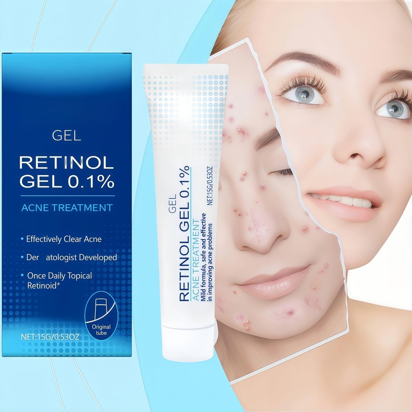 Retinol Gel,Acne Treatment Gel,Acne Control Cream for Face,Anti Acne Gel for Spot Prone Skin,Retinol Moisturizer Cream,Brightens Skin and Improves Elasticity,Face for Pimple Reduce,Without Over Drying
