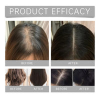 Fankayi Deoxyribose Sugar Gel Hair Growth,Hair Thickening Essence,Hair Serum for Hair Growth,Hair Oil for Dry Damaged Hair,Hair Breakage Treatment,Deeply Nourish and Repair,Scalp Care and Moisturizing