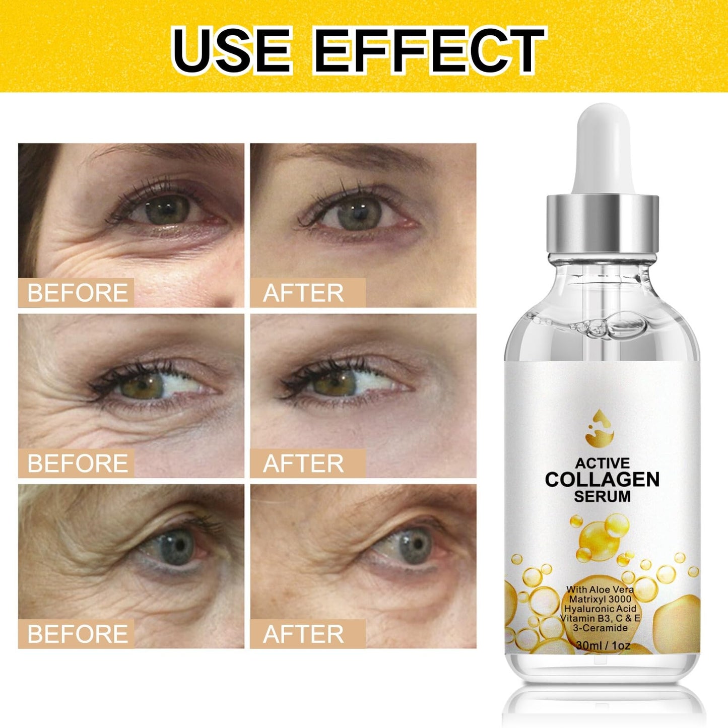 IZBEAUVO Collagen Serum,Vitamin C Serum For Face,Deep Wrinkle Filler For Women & Men,Boosts Collagen,Repairs,Moisturizing,Firming Face Cream,Skincare,With Hyaluronic Acid,Niacinamide,30ml