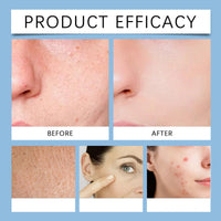 Ruojiar 70 Pads Zero Pore Pads,Dual-Textured Facial Toner Pa/ds for Exfoliation and Minimizing Pores,Face Cleansing Pa/ds,Shrink Po/res Facial Exfoliating P/ad,Korean Skin Care,Gentle Exfoliator Face