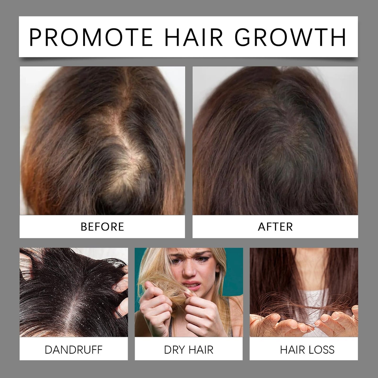 Ruojiar 30ml Men and Women Hair Growth Serum,Hair Growth Oil with 5% Biotin,Wild Hair Gro/wth Oil,Hair Regrowth Treatment,H/air Serum for Hairgrowth with Biotin,Thicken and Strengthen for Ha/ir Regrowth