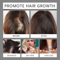 Ruojiar 30ml Men and Women Hair Growth Serum,Hair Growth Oil with 5% Biotin,Wild Hair Gro/wth Oil,Hair Regrowth Treatment,H/air Serum for Hairgrowth with Biotin,Thicken and Strengthen for Ha/ir Regrowth