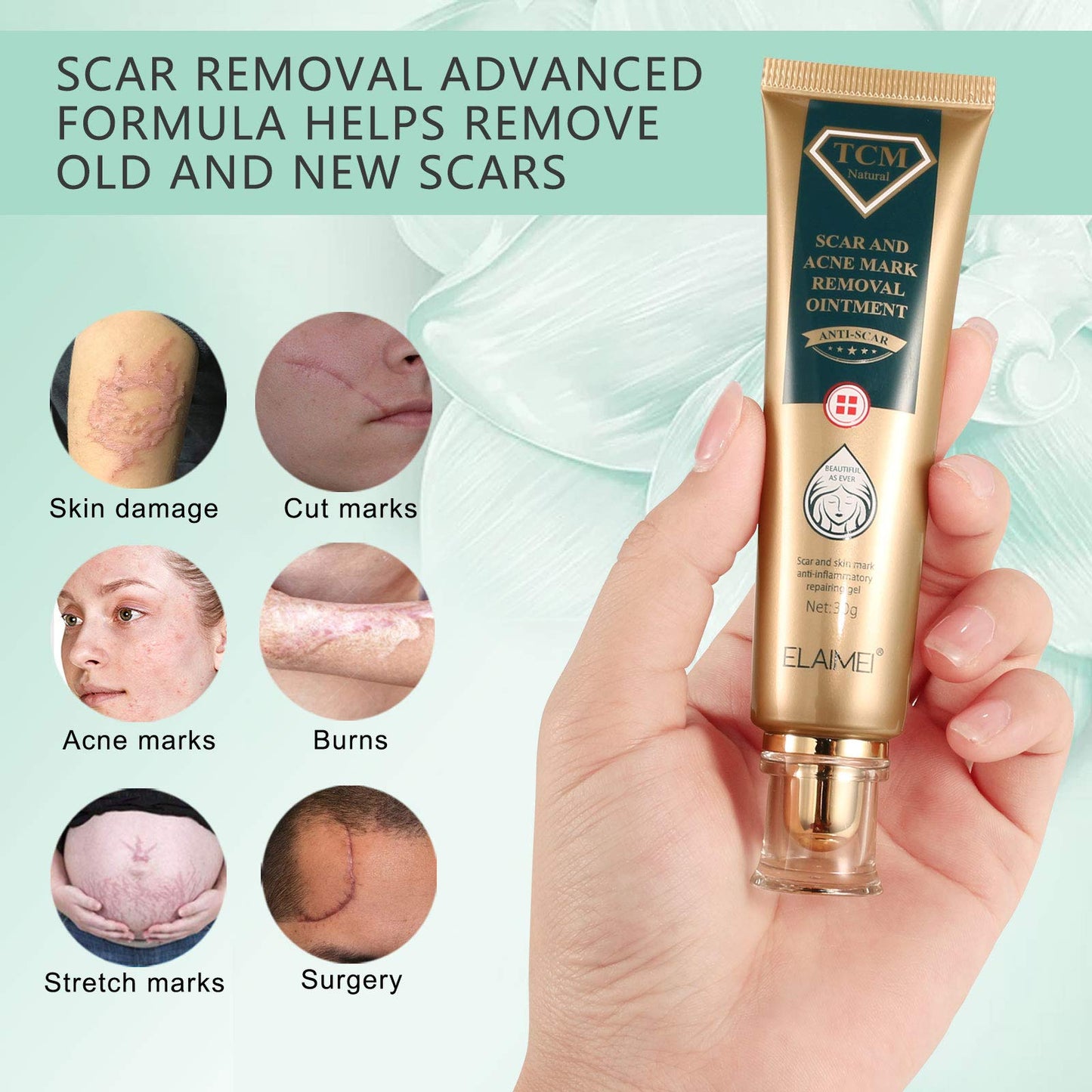 JSBNQRMZ Bump Removal Gel,30g Scar cream,Safe Non-Greasy Formula for Scars, Keloids & Piercing Bumps | Soothing Piercing Aftercare Gel,Keloid Scar, Acne Scar, New and Old Scars