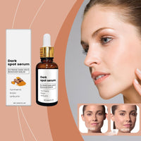 Dark Spot Remover Serum,D/ark S/pot Corrector Daily Face S/erum,Da/rk Sp/ot Correcting Glow Se/rum,Dark Spo/t Remover,Spot Treatment,Moisturiser Fa/ce Women,Face Oils for Women,Hydrating Serum