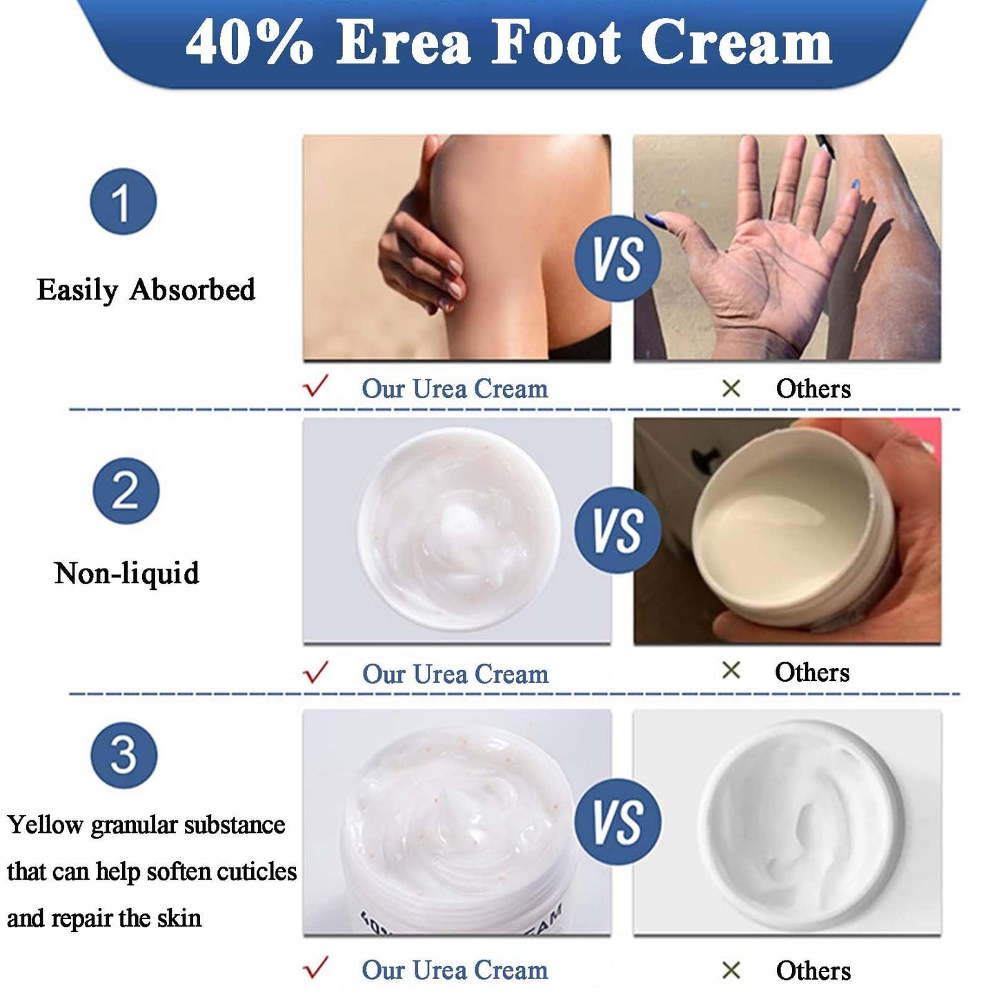 NLFOX Urea Foot Cream - Urea Cream for Cracked Heels and Dry Skin - Urea Cream 40% for Feet - Deep Moisturizing Foot Cream Treatment Maximum Strength Urea cream for Callused Rough Skin