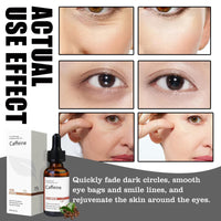 Jinjiar Caffeine & Hyaluronic Acid Under Eye Serum,Caffeine Eye Serum,Under Eye Cream for Dark Circles and Puffy Eyes,Eye Serum for Dark Circles,Eye Cream Anti Aging,Firming Eye Cream,Under Eye Treatment