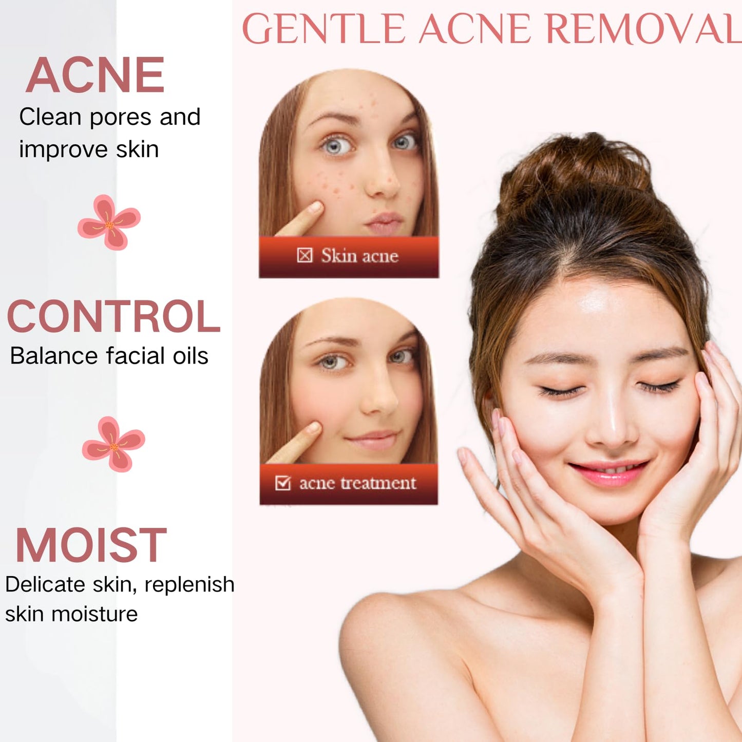 ISBEAUSOLS 2pcs Acne Tratment Face Gel 15% Acid - Spot Treatment For Face - Acne Treatment for Spot Prone Skin - Spot Gel for Women,Men,Teenager - Clean Skin,Pimple Reduce,Blackhead Remover
