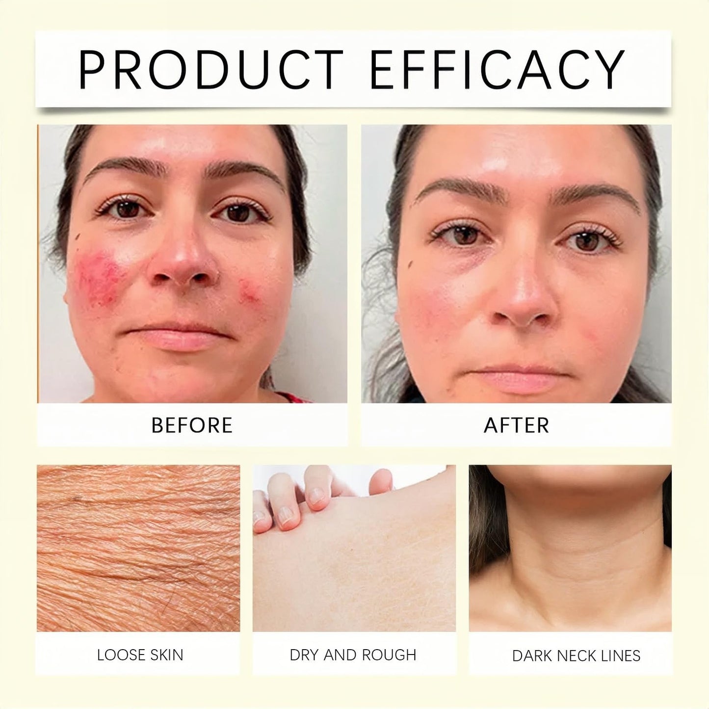 Xunzhi Skin Cream,Skin Cream Intimate Area,Body C/ream for Women,Intimate Area Dark Spot Corrector Lightening C/ream for Body,S/kin Lightening Cr/eam f/or Underarm,Whitening Cr/eam,Cre/am f/or Dry Sk/in