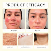 Xunzhi Skin Cream,Skin Cream Intimate Area,Body C/ream for Women,Intimate Area Dark Spot Corrector Lightening C/ream for Body,S/kin Lightening Cr/eam f/or Underarm,Whitening Cr/eam,Cre/am f/or Dry Sk/in