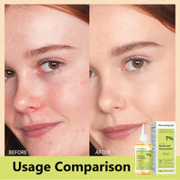 Sengwer Glycolic Acid Toner,Glycolic Acid 7% Toner for Exfoliating, Suitable for Combination and Oily Skin - Hydrating Serum for Face (240ml New)