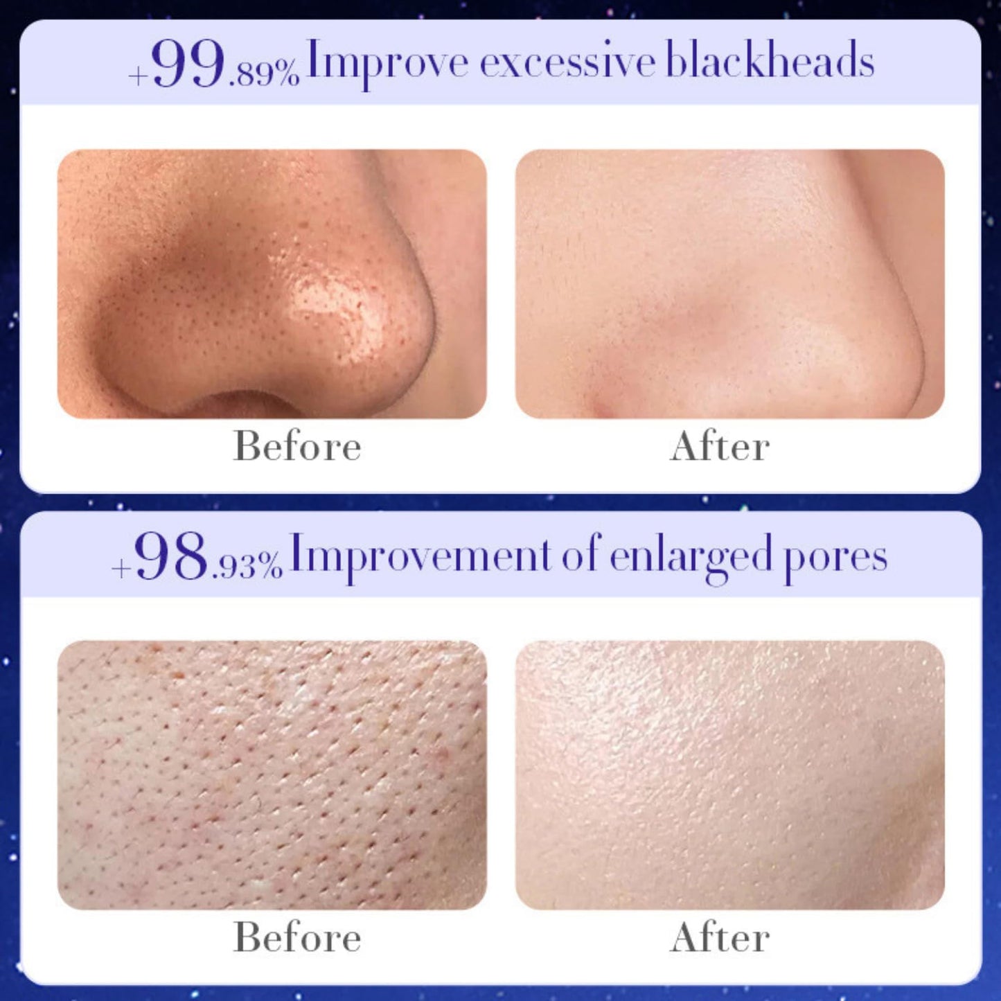 TBeautfave Peel off Face Masks, Starry Sky Face Peel Anti Wrinkle Anti Aging Facial Mask, Oil-Control Anti-Acne Detox Cleansing Skin Care Face Lifting Firming Mask