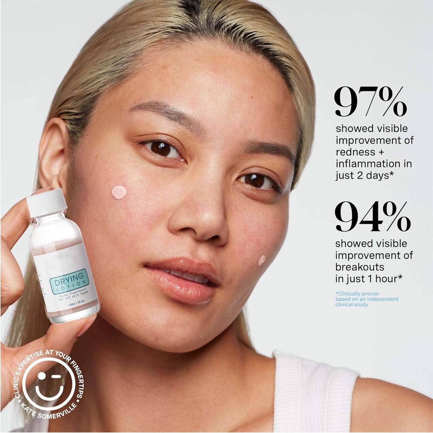 Eveloveu Anti-Acne Serum & Drying Lotion – Fast-Acting Acne Treatment to Dry Out Blemishes, Reduce Pimples & Redness. Gentle Acnecide Face Lotion for Teenage Girls, Women & Men – Clear, Healthy Skin Care