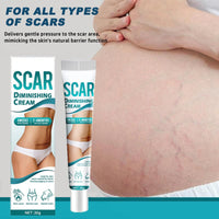 AuraBeen Scar Cream for Face & Body - Assists in Enhancing The Look of Stretch Marks, C - Section Scars, Surgical Scars - Suited for Old & New Scars - Facilitates Skin Restoration