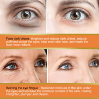 Hydrating Vitamin C Eye Cream Stick for Dark Circles & Puffy Eyes - Reduces Puffiness & Fine Lines - Cooling Anti-Aging Eye Balm for Men & Women