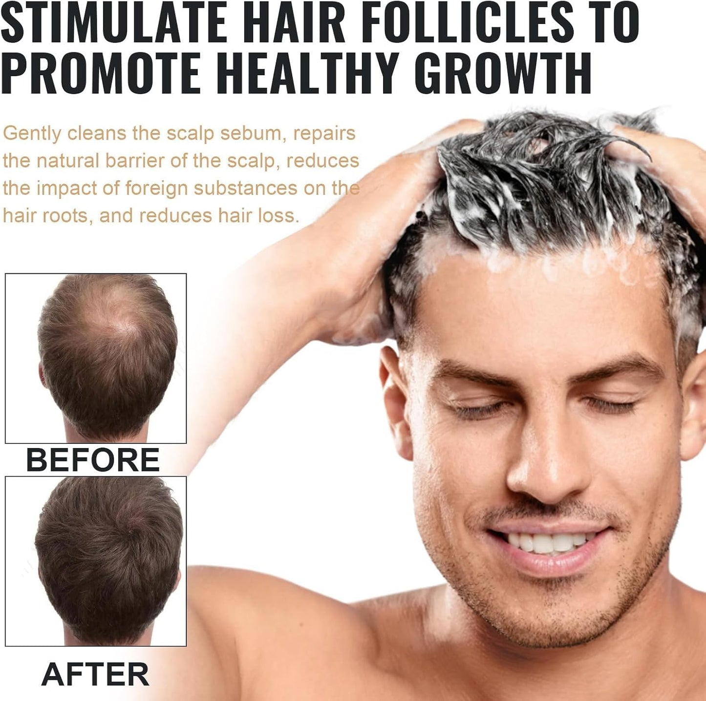 Generic Root Activator Shampoo,Mane Root Activator Shampoo for Man,Unisex Hair Loss