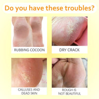 ISBEAUSOLS Honey Foot Cream - Cracked Heel Repair Cream With Coconut Oil, Shea Butter, Beeswax-Foot Cream For Cracked Heels And Dry Skin- Softens & Moisturises Rough, Hard, Cracked, Callused Feet 2PCS