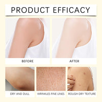 Herbal Cream,East Asian Natural Herbal Cream Set,Moisturising Cream with Botanicals,Body Lotion for Dry Skin,Firming Body Lotion,Skin Tightening Cream,Lock in Moisture and Nourish,Gentle Care