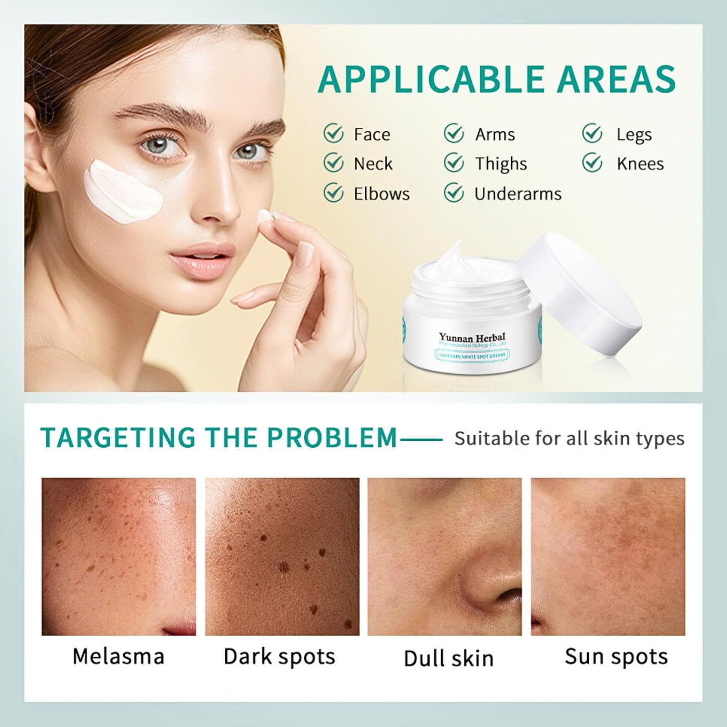 Yunnan Herbal Melasma Cream, Dark Spot Remover for Face Spot Cream, Freckle Removal Cream with Arbutin Niacinamide, Sun Spots, Freckles, Blemish Melasma Treatment for Face Cream, 20g