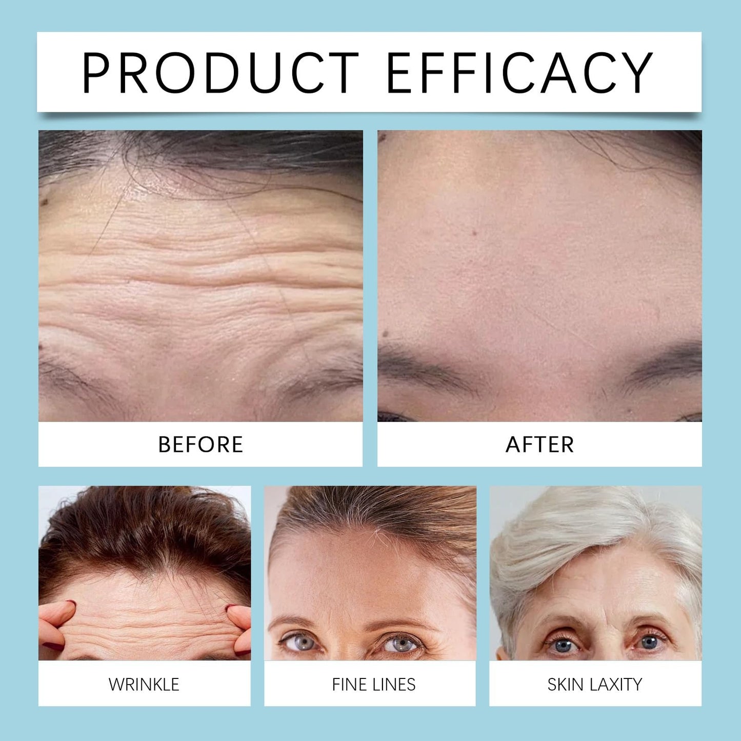 Xunzhi 60 PCS Forehead Wrinkle Patches,Forehead Anti Wrinkles Patches,F/orehead P/atches for Wrinkles,Hydrating Facial P/atches,Frown Line Remover Mask,Face Tape,Frown Line Pa/tches with Hyaluronic Acid