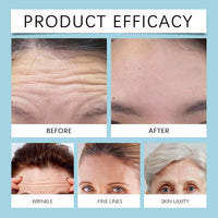 Xunzhi 60 PCS Forehead Wrinkle Patches,Forehead Anti Wrinkles Patches,F/orehead P/atches for Wrinkles,Hydrating Facial P/atches,Frown Line Remover Mask,Face Tape,Frown Line Pa/tches with Hyaluronic Acid