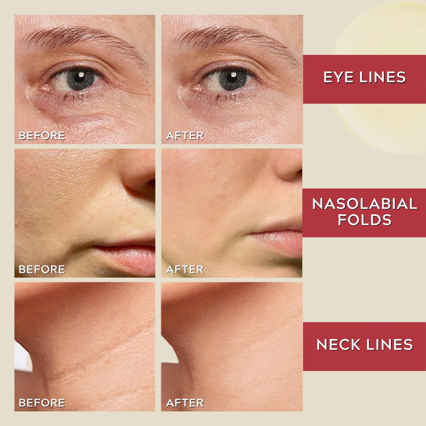 TBeautfave 1988 Serum : Retinal Liposome 2% + Black Ginseng, Retinol Serum for Face Smooth Wrinkles, Retinal Face Serum Anti Aging, Pigmentation Care, Enhance Skin Elasticity, Brighten Skin Tone, 30ml