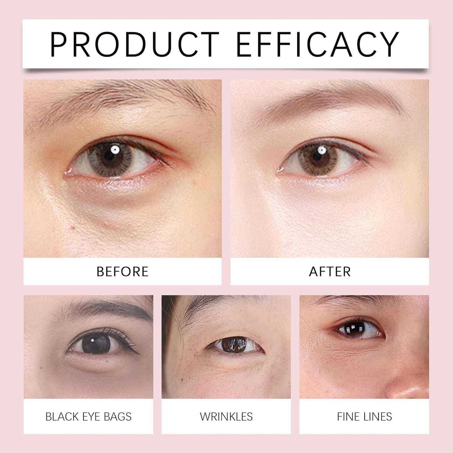 Generic Massage Eye Cream for Dark Circle, Tired Eye Refreshment with Gentle Vibration,Firm and Smooth of Fine Lines, for Anti-Wrinkle, Firming, Moisturizing