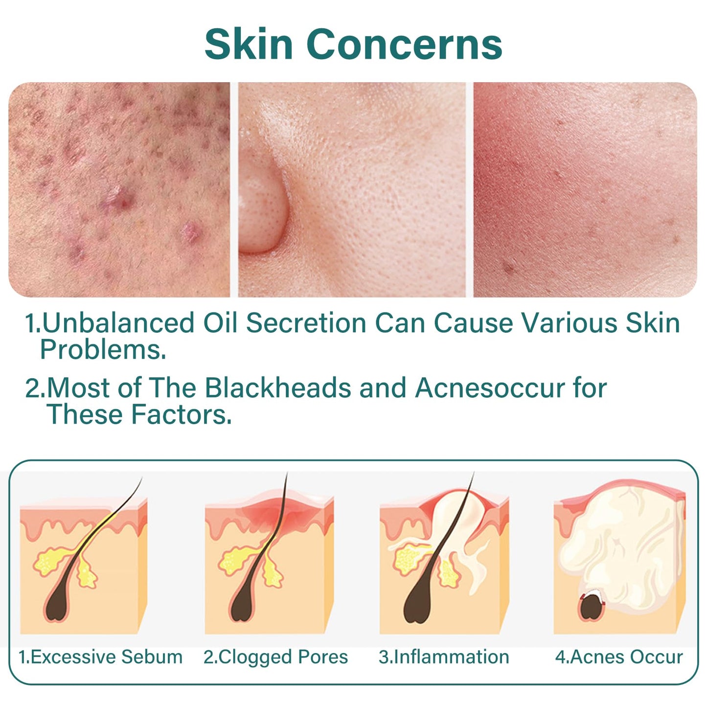 Leogony 7PCS Skincare Set for Teenagers Girls & Boys, Acne Skin Care Set for Teenage, Tea Tree Face Wash Gift for Mens Woman