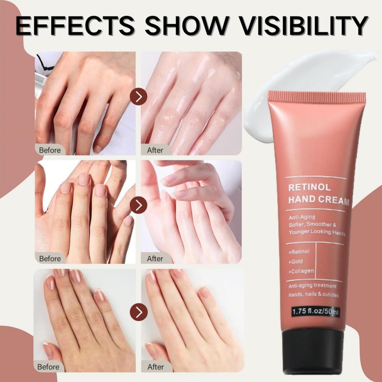 Yoowan Reti-Nol Hand Cream,Hand Cream For Very Dry Ha-Nds,Anti Aging Ha-Nd Cre-Am,Reti-Nol Moisturising Cre-Am,Deep Nourishing,Non-Greasy,Moisturizer For Aging&Dry Cracked Ha-Nds,Protects Skin,Nails,Cuticles