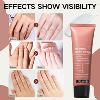 Yoowan Reti-Nol Hand Cream,Hand Cream For Very Dry Ha-Nds,Anti Aging Ha-Nd Cre-Am,Reti-Nol Moisturising Cre-Am,Deep Nourishing,Non-Greasy,Moisturizer For Aging&Dry Cracked Ha-Nds,Protects Skin,Nails,Cuticles