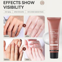 Fankayi Retinol Hand Cream,Firming Anti-Aging Hand Lotion,Retinol Hand Cream Anti Aging,Hand Repair Cream,Retinol Moisturizer Cream,Soft & Supple Hands,Travel Size Hand Lotion,Suitable for Dry Skin