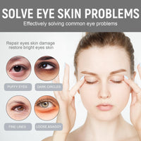 Retinol Intense Reactivating Eye Cream,Retinol Eye Cream,Dark Circles Under Eye Treatment Women,Anti Aging Eye Cream,Eye Cream for Dark Circles and Puffy Eyes,Eye Bags Remover,Eye Cream for Wrinkles