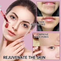AHA BHA Exfoliating Serum for Acne, 12% AHA BHA PHA LHA Peeling Solution, Exfoliating Serum for Face, BHA Serum for Pores, Overnight Exfoliating Serum for Clear & Smooth Skin, Reduces Pore Congestion