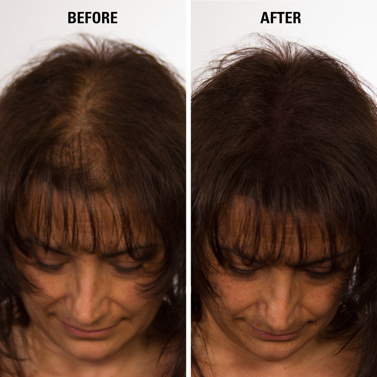 Infinity Hair Building Fibers To Conceal Thinning For The Appearance Of Thicker, Fuller Women & Men - Auburn 28G