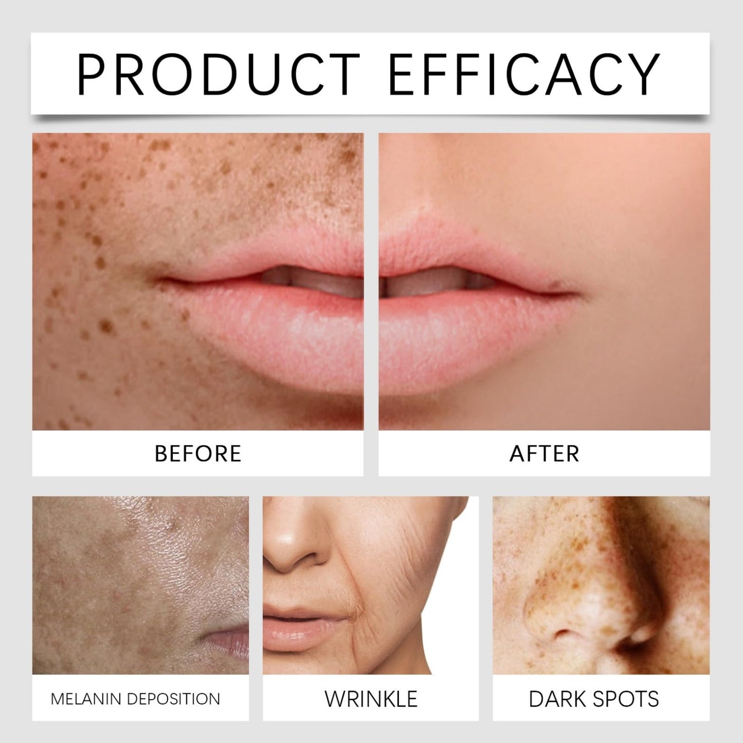 Ruojiar Freckle Removal Cream,Dark Spot Remover for Face and Body,Dark Spot Corrector Freckle Remover,Skin Brightening Cream,Moisturizing Anti-blemish Cre/am,Da/rk Spot Correcting Glow Serum,Spot Cre/am