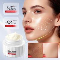 ISBEAUSOLS Kojic Acid Cream - Skin Lightening Cream for Anti Aging - Dark Spot Remover for Face - Hydrating Face Moisturiser for Dry Skin - Face Cream for Women - Anti Wrinkle Face Care, Moisturising,50g