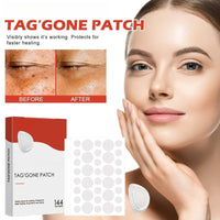 OuXing 288PCS T-ag'gone Patch,Spot Stickers,Nano Patch for Face and Skin,Face Care P/atch,Acne Pimple Patches,Skin T-ag Remover Patches,M-ole Remover,Skin Ta-g P/atches,Skin Ta-g R/emover,W-art Treatment