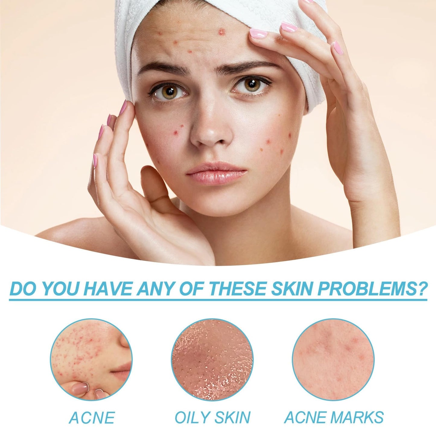 Acne Control Cream for Face,Face Serum for Acne Treatment,Acne Gel Fast Absorbing Spot Treatment,Fast Acting Spot Treat/ment for Fa/ce,Fungal Acn/e Treatm/ent for Women,Gel for Sp/ot Prone Skin