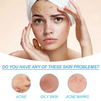 Acne Control Cream for Face,Face Serum for Acne Treatment,Acne Gel Fast Absorbing Spot Treatment,Fast Acting Spot Treat/ment for Fa/ce,Fungal Acn/e Treatm/ent for Women,Gel for Sp/ot Prone Skin