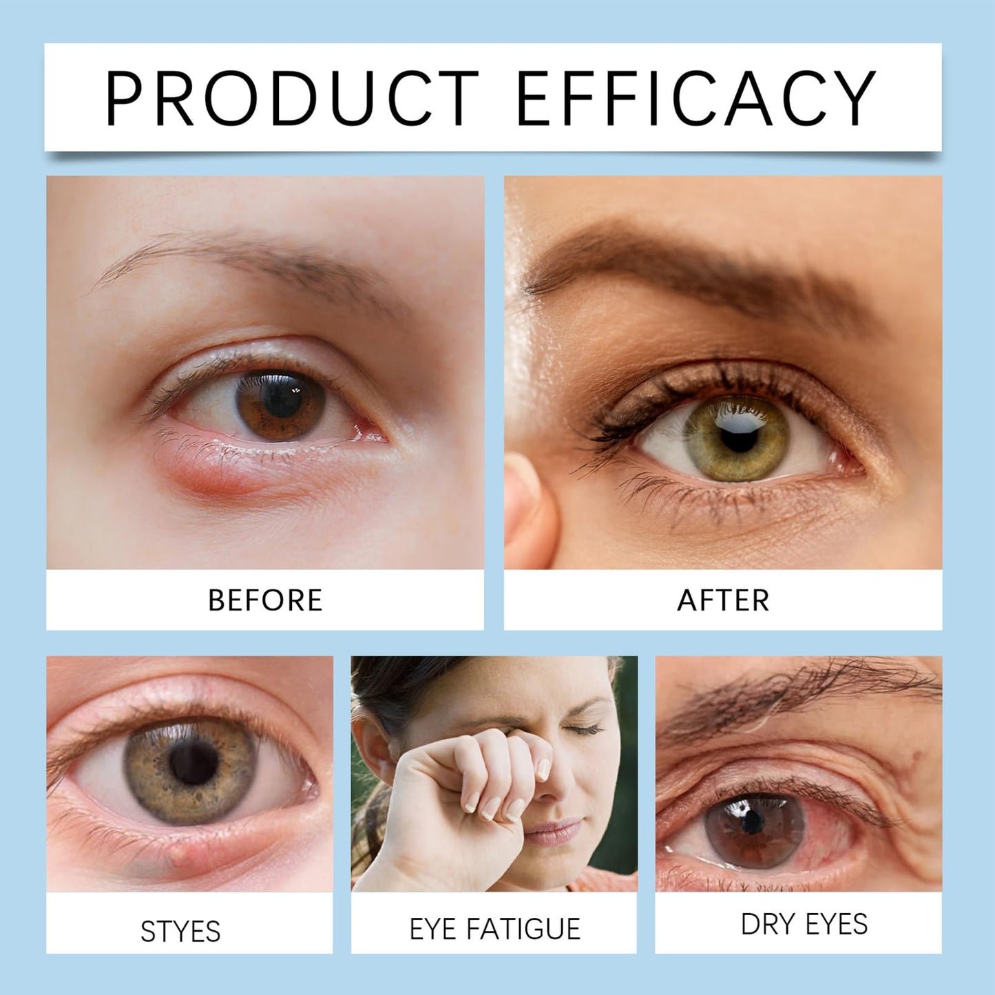 Stye Eye Treatment, MrCuvaryas Under Eye Serum,Natural Stye Eye Serum for Styes,